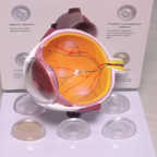 ПОЛЕЗНО ЗНАТЬ: ночные линзы